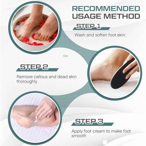 Lothee 30 Pack Double Sided Foot File Callus Remover - Pedicure Tool for Dead Skin & Cracked Heels, White, Variation 30