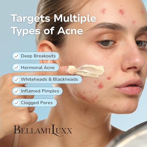 1-Pack Cystic Acne Spot Treatment with Salicylic Acid & Tea Tree Oil for Face