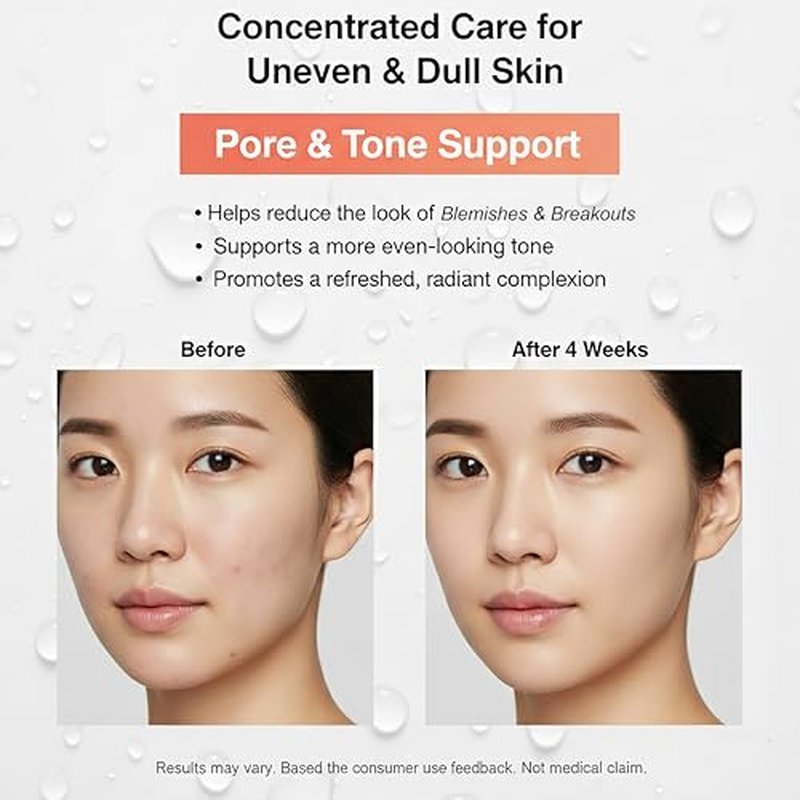 15% Niacinamide Serum for Face - with Vitamin C, Glutathione - Korean Dark Spot Serum for Uneven Tone, Enlarged Pore, Dullness, Ance-Prone, Sensitive Skin - Fragrance-Free, Daily Use