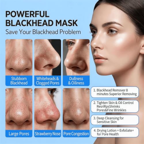 Blackhead Remover & Pore Minimizer Clay Mask 3.53 oz - Non-Drying, Hydrating Skin Care