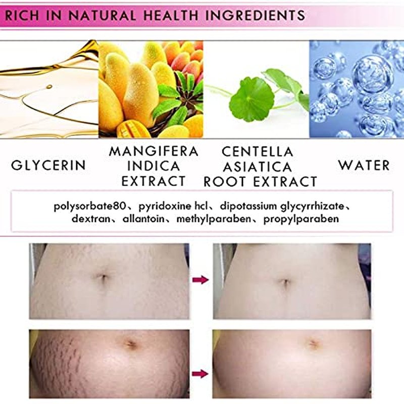 Mango Stretch Marks and Scar Cream, Stretch Mark and Scar Removal Cream for Pregnancy, Belly Creams for Wrinkles, Obesity Fat Marks Scars Moisturizing, Remove Marks (40g)