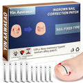 Titanium Alloy Ingrown Toenail Treatment - Professional Home Care for Curved Nails - Waterproof, Nail Tools and Ingrown Toenail Removal Kit,Ingrown Toenail Corrector(0.59/0.67in)