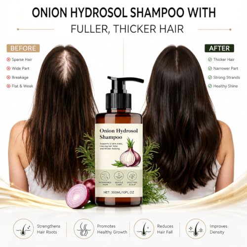 Onion Hair Growth Shampoo with Rosemary & Biotin - Thickening & Strengthening Formula for All Hair Types - 10 fl oz