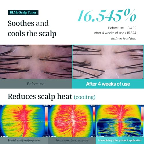 Hair Growth Serum for Thinning Hair and Scalp Health - Clinically Proven & Drug-Free, 4.05 fl oz