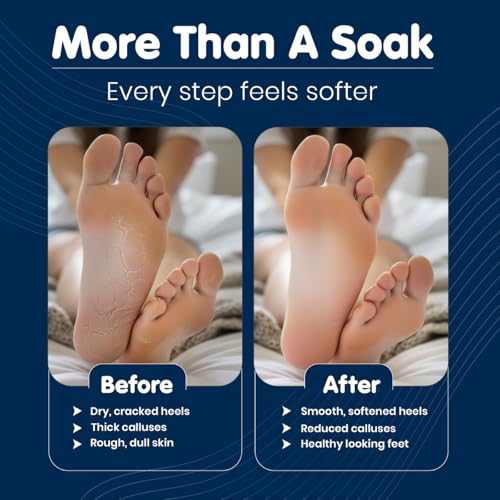 Pedicure Strength Foot Soak for Cracked Heels & Calluses ? Professional Epsom Salt Soak to Soften Hard Skin, Rough Feet & Thick Calluses ? Used by Foot Care Professionals Since 2001