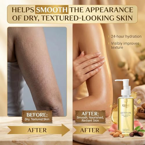 SDUQULK ERAE Queen Botanical Body Oil 120ml - Lightweight Moisturizer for Arms, Tummy & Thighs, 1PC