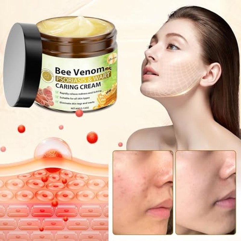 Bee Venom Skin Treatment Cream, Bee Venom Cream for Women and Men, Natural Bee Venom for All Skin Types, 2.12 OZ