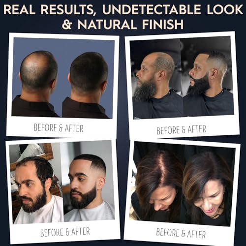 Hair Illusion Black Hair Fibers for Thinning Hair - 18g Natural Real Hair, Non-Synthetic, Cover Bald Spots - Pack of 1