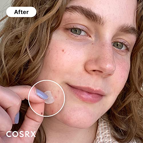 COSRX Acne Pimple Patches 3 Sizes Pack of 240 - Absorbing Hydrocolloid Spot Treatments