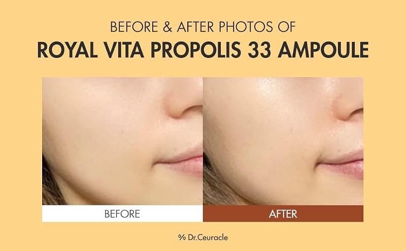 Hydrating Vitamin Serum with Royal Jelly & Propolis - Face Brightening & Anti-Aging