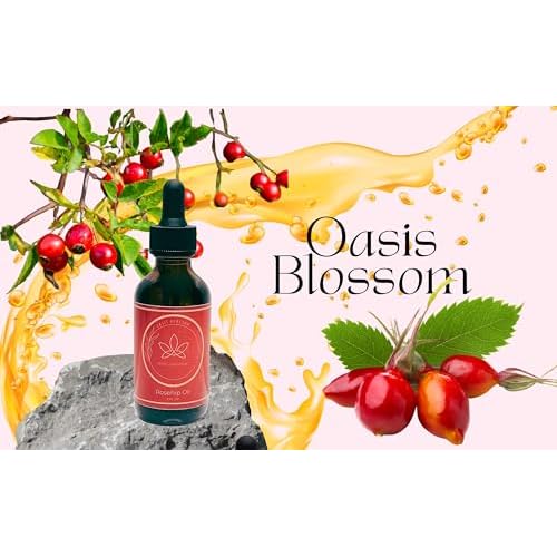 Rosehip Oil for Face, Skin & Hair| 100% Pure Certified USDA Organic | Cold Pressed Unrefined Rosehip Oil | Hydrating, Moisturizing, Nourishing, Anti-Aging | 2 Fl Oz.