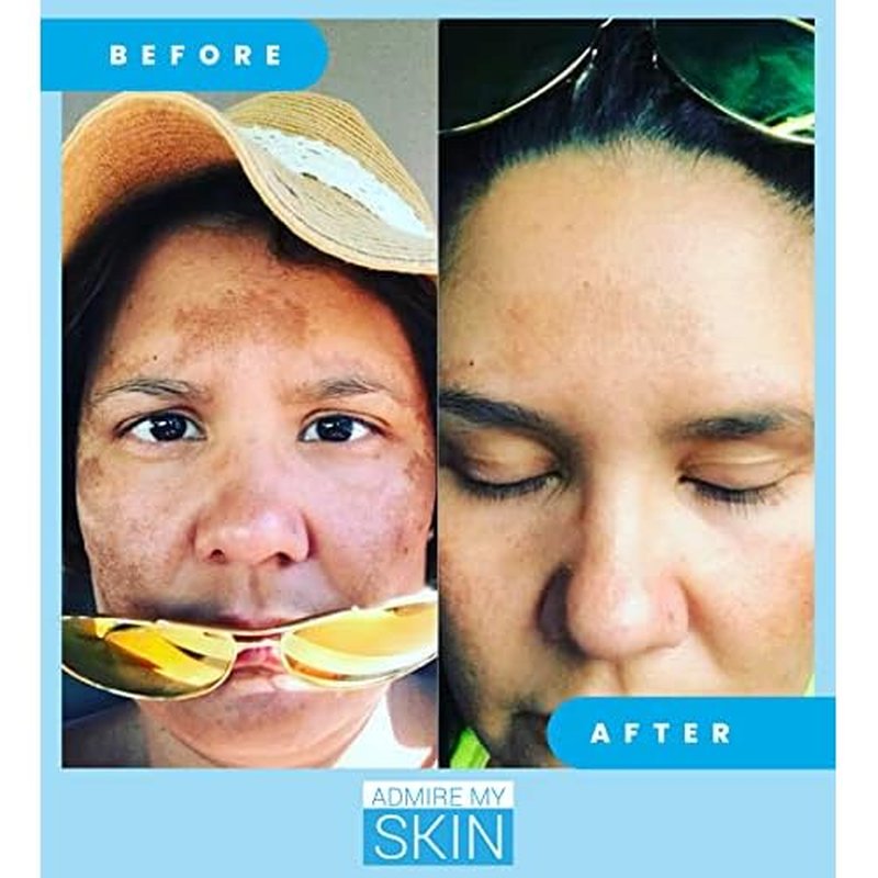Admire My Skin Dark Spot Corrector Serum + Retinoid Cream Set