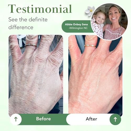 Dermatologist-Recommended Skin Barrier Repair Balm for Dry Sensitive Skin 6 Oz
