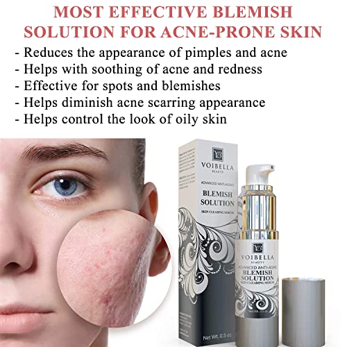 VOIBELLA Acne Spot Treatment Serum for Pimples & Redness, Gentle Skin Care