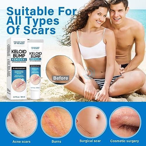 Keloid Bump Cream, Silicone-Based Scar Cream for Face & Body, Advanced Formula to Improve Appearance of Keloids & Raised Scars, 0.7 Fl Oz