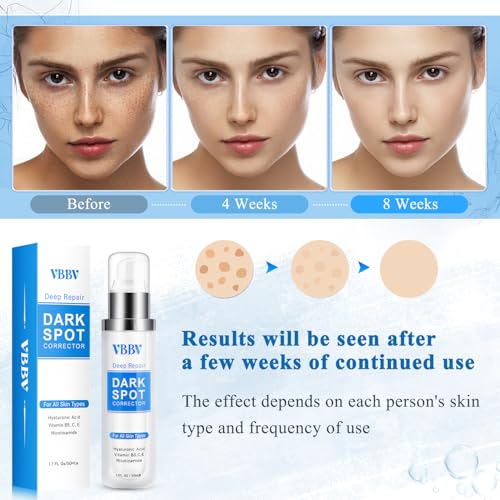 Dark Spot Remover for Face and Body, Dark Spot Corrector, Sun Spot Freckles Hyperpigmentation Treatment, Advanced Dark Spot Remover Cream with Niacinamide for Women and Men (1.7 Fl Oz)