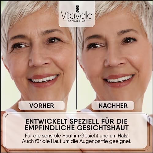 VITAVELLE Hydrating Face Mask ? Hyaluronic Acid Moisturizer Mask Firming with Avocado Oil, Shea Butter, Aloe Vera and Jojoba Oil ? Vegan Face Mask with No Parabens ? Hydrating Face Masks Anti Aging