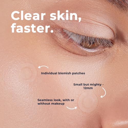 VitaMedica Clear Skin Spot Dots 6-Pack