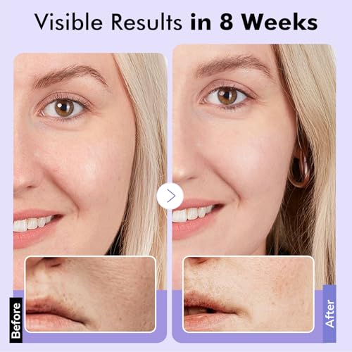 Bakuchiol Retinol Serum for Face - Anti-Aging, Dark Spots, Fine Lines, 30ml
