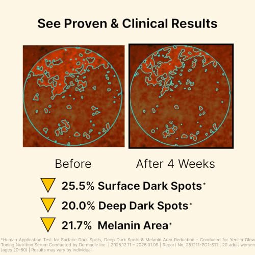 Korean Dark Spot Corrector Serum with Alpha Arbutin & Glutathione - Brightening Face Treatment