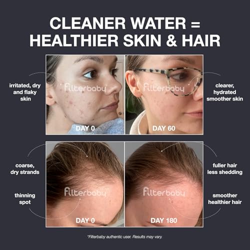Chrome Diamond Shower Filter for Skin & Hair - Chlorine Reduction