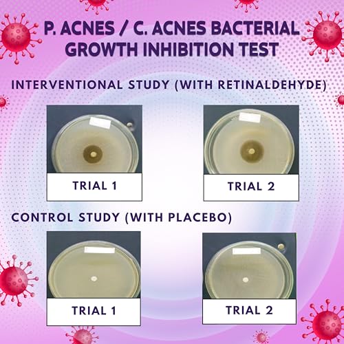 FSA HSA Acne Treatment | Anti-Bacterial Pimple Patches | Fast Acne Drying Treatment | Dual Action Acne Patch | Hydrocolloid Spot Cover | Zit Stickers | Korean Healing Dots | Soothing | 72 Counts |