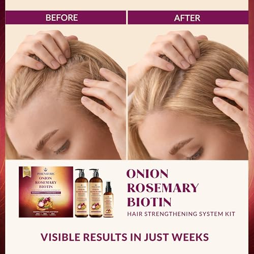 PureNaturis Onion Rosemary Biotin Hair Care Set - Sulfate-Free Shampoo, Conditioner & Serum for Stronger, Thicker Hair