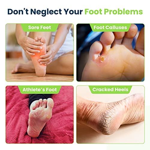 Tea Tree Oil Foot Balm - Foot Moisturizer for Dry Cracked Feet - Instantly Hydrates & Soothes Irritated Skin & Athletes Foot - Best Foot Care for Women and Men & Tea Tree Foot Soak, Callus Remover Gel