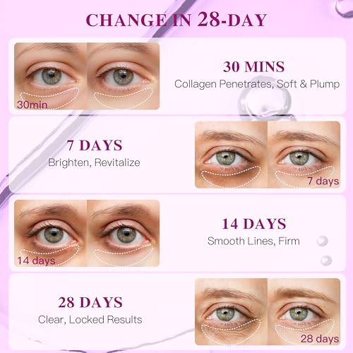 Hyaluronic Acid Collagen Under Eye Patches - 12 Pairs Deep Hydrating Eye Mask for Puffiness & Dark Circles - All-Day Moisture