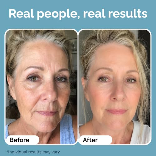 Moisturizing Eye Contour Cream with Caviar & Algae Extracts - Mature Skin Care