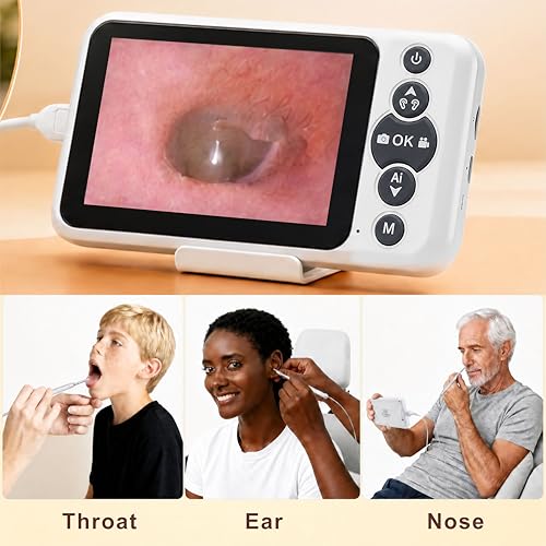 Digital Otoscope with 4.5-Inch HD Screen, No Phone Needed Ear Camera with Light