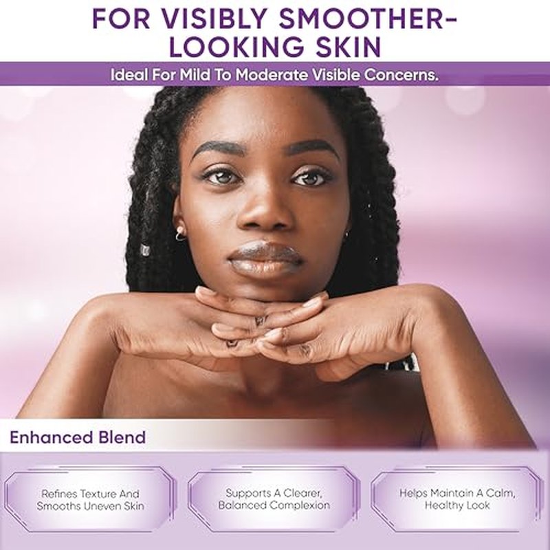 Azelaic Acid Cream for Face: Redness-Soothing Azelaic Acid Facial Cream for Uneven Tone, Blemish-Prone Skin, Pore Care and Skin Clarity Support, 1 oz