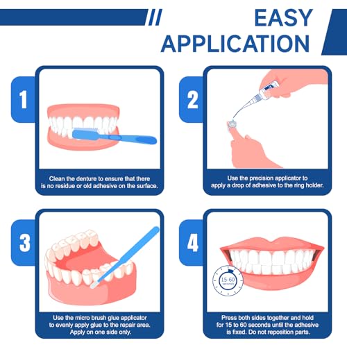 Kedicare Denture Repair Glue Kit - Instant Bonding for Cracks & Loose Teeth