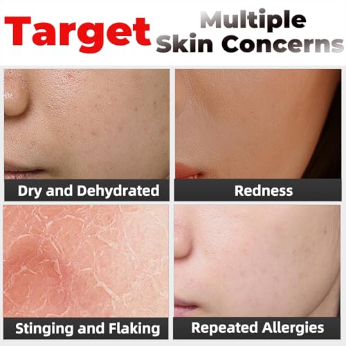 Elitzia Skin Care Oxygen Facial Machine Essence Oxygen Device for Skin 1.69 fl.oz Xylitol Nutrient Solution Yellow Hydration Keep Soft & Elasticity Anti Aging & Wrinkle Beauty Care Home Use