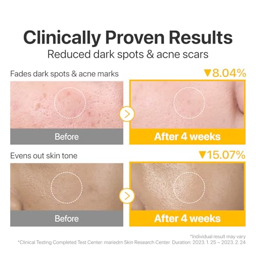 Dark Spots Serum Set with Glutathione & Vitamin C for Brightening