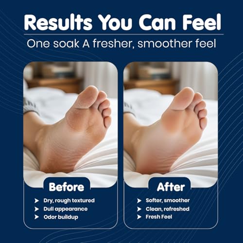Wellness Detox Foot Soak with Epsom Salt & Lavender ? Relaxing Spa Foot Soak for Tired Feet, Stress Relief & Daily Foot Care ? Trusted by Professionals Since 2001