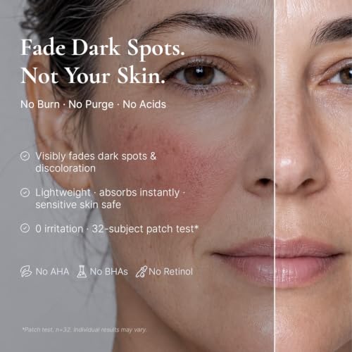 Dark Spot Corrector Serum for Face & Body - 1 Fl Oz - Niacinamide & Hyaluronic Acid