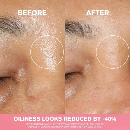 Radiant Skin Toner with Niacinamide - Pore Minimizer & Hydrating Essence, 6.7 Fl Oz
