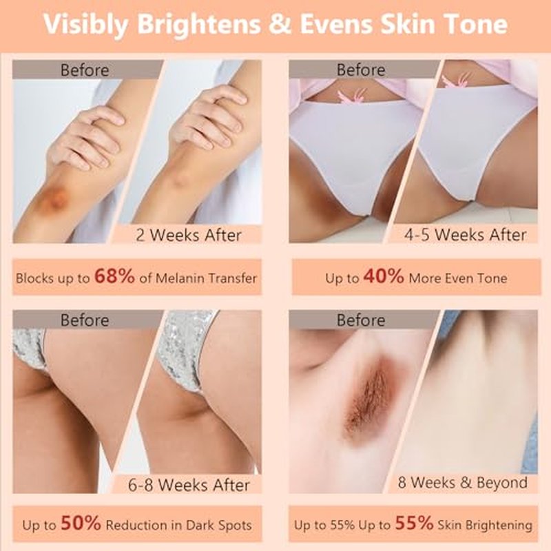 100ml Skin Bleaching Cream - Dark Spots Remover Lightening Cream & Uneven Tone Nourishing Formula Bleaching Intimate Areas & Underarms Inner Thigh, Bikini Line, Armpit Knees Elbows for All Skin Types