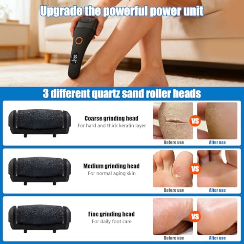 Dermawave Electric Foot File Callus Remover for Feet, Professional Foot Sander Grinder with 60 Sandpaper Discs for Men & Women, Pedicure Tool for Corn Dead Skin Cracked Heel