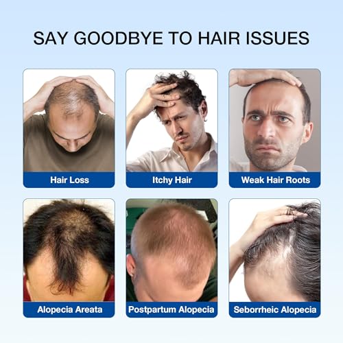Hair Loss Shampoo for Men & Women - DHT Blocker & Hair Growth - 7 Fl Oz - Blue Label