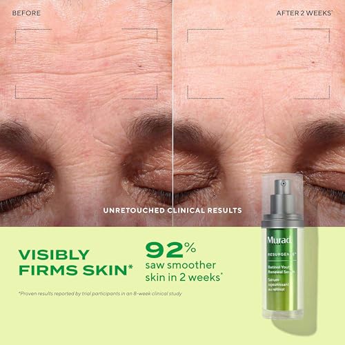 Murad Retinal Trial Kit - Lift and Resculpt with Retinal 2-Piece Trial Kit ($73 Value) - Anti-Aging Set Encapsulated Retinal - Retinal Serum 0.5Fl Oz, Retinal Eye Cream 0.11Fl Oz