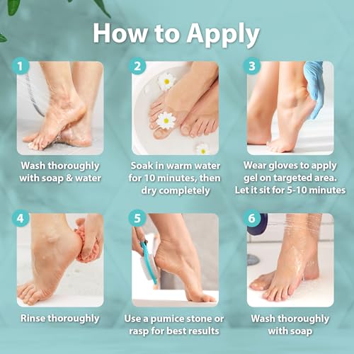 Ebanel Professional Callus Remover for Feet with 20% Urea, Epsom Salt, Salicylic Acid, Glycolic Acid, Heel Toe Foot Callus Remover Gel Peel Exfoliator Dead Skin Removal for Feet, Cracked Heel Repair