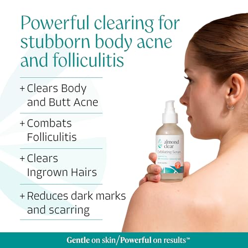 Almond Clear Level 2 Mandelic Acid Body Serum 4 oz - Acne, Blemish & Dark Spot Treatment