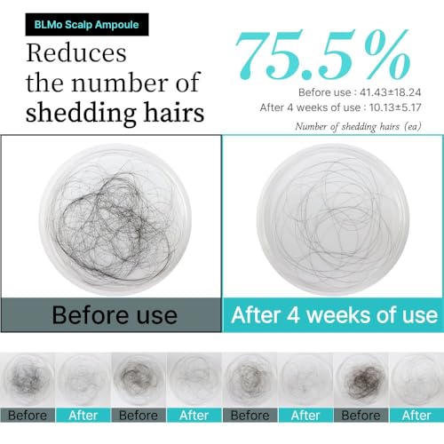 Hair Growth Serum Roll-On for Thinning Hair & Scalp Health - Clinically Proven, DHT Balance Support, Korean Formula, 0.5 fl oz