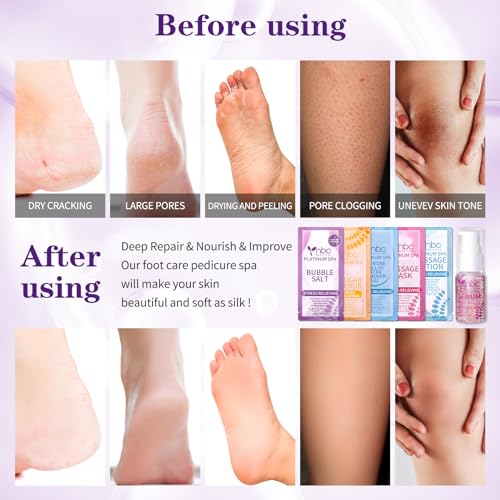 Pedicure Foot Soak Set - Upgraded 6 in 1 Foot Spa, Foot Bath Spa, Pedicure Kit for Tired & Dry Cracked Feet, Athletes Feet, Bad Odor, Softens Calluses (3 Set Lavender)