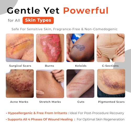 Silicone Scar Gel for Old & New Scars, Keloids, C-Section, Burns, Acne, Surgical Scar Treatment ? Cosmetic Formula with Patented Silicone & Sea Berry Oil, Clinically Tested, Made in USA