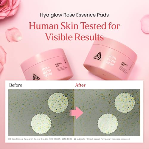 Neogen DERMALOGY Hyal Glow Rose Essence Pad ? Hydrating, Firming & Radiance Boosting Toner Pads Infused with Rose Water, Niacinamide, Adenosine & 8 Types of Hyaluronic Acid 70 Pads / 4.6fl.oz