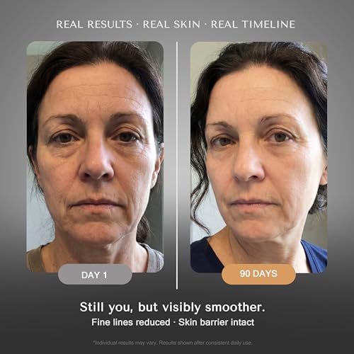 SOLURETINOL Retinol Face Serum Duo - Anti-Aging Wrinkle & Moisture Boost for Eyes & Neck (1-Pack)