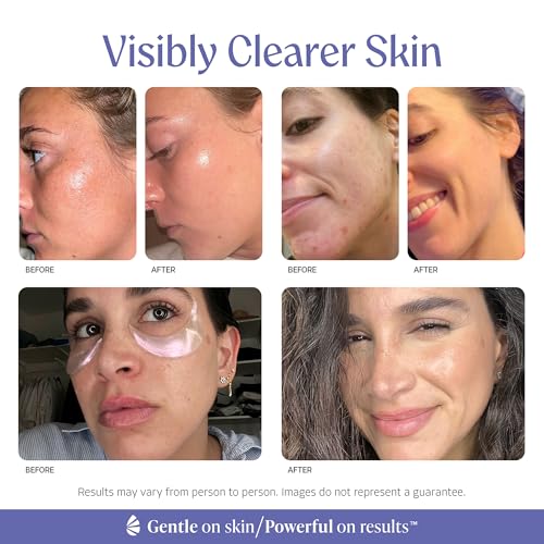 2-in-1 Hydrating Gel Moisturizer for Oily Skin with Aloe Vera & Hyaluronic Acid